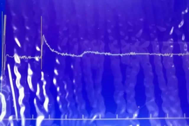 û巨Բ